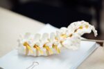 Addressing Curves: Adult Scoliosis Treatment Strategies