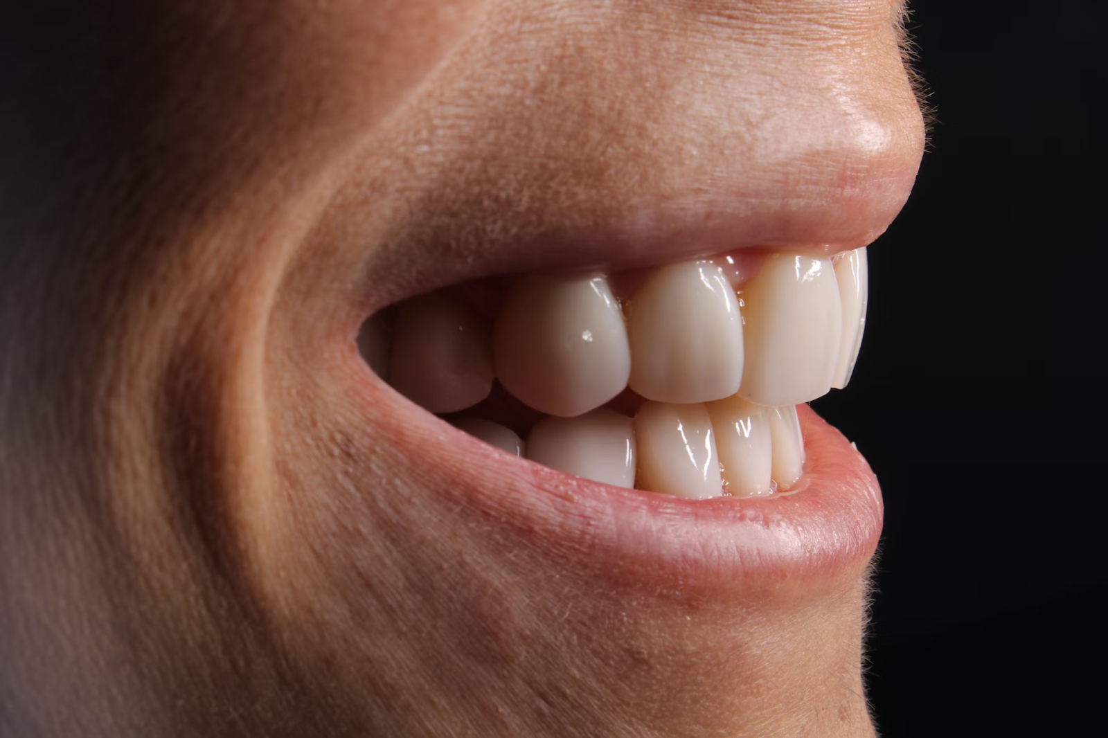 Understanding Your Options for Replacing Missing Teeth